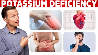 Low Potassium Signs Symptoms Causes and Treatment [upl. by Wendie]