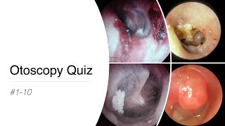 Otoscopy Quiz 1  10 [upl. by Delainey]