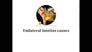 causes of tinnitus [upl. by Airdnua]