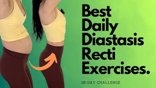 Heal amp Flatten With These Daily Diastasis Recti Exercises [upl. by Joshia]