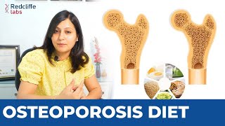 ✅ कमजोर हड्डी के लिए डाइट  Osteoporosis Diet Plan in Hindi  ✅ Best Foods for Osteoporosis patients [upl. by Odlareg]