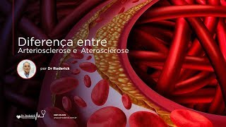 Diferença entre Arteriosclerose e Aterosclerose  Por Dr Roderick [upl. by Bergh]