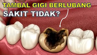 Tambal gigi berlubang sakit tidak❓🙄 [upl. by Arikahs]