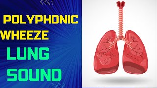 Polyphonic Wheeze Lung Sounds Collection [upl. by Cirda]