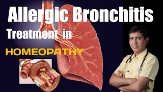 Allergic Bronchitis Symptoms and Treatment in Hindi  Allergic Bronchitis Treatment in Homeopathy [upl. by Neelloc]