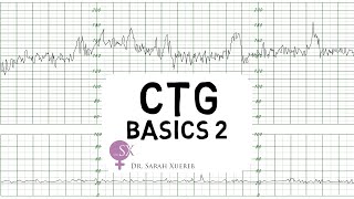 CTG Basics Part 2  Decelerations amp Fetal Physiology [upl. by Harmon769]