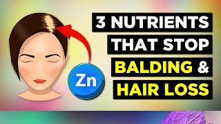 The BEST 3 Nutrients To Prevent Balding Hair Loss [upl. by Meadow550]