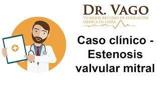 Estenosis Valvular Mitral  Caso Clínico ENARM [upl. by Kalli]