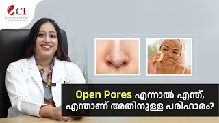 Open Pores എന്നാൽ എന്ത് എന്താണ് അതിനുള്ള പരിഹാരം [upl. by Annairam]