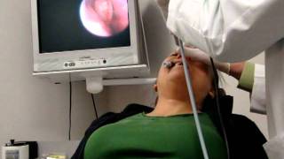 FinESS Sinus Treatment  Physician Instructional Video [upl. by Dionisio]