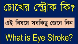 Eye Stroke bangla eyeStroke retinalIschemia retinalHemorrhages treatmentOfEyeStroke [upl. by Eric444]