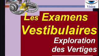 Différents examens vestibulaires diagnostic des vertiges [upl. by Neleag301]