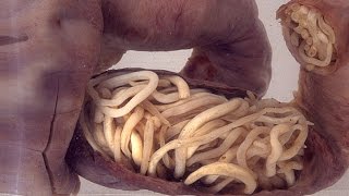 Top 10 Human Intestine Parasites Narrated [upl. by Goldia]