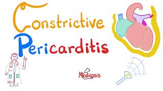 Constrictive Pericarditis  Causes Symptoms Signs Diagnosis amp Management  Cardiology [upl. by Sturdivant984]