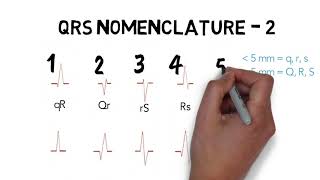 ECG QRS NOMENCLATURE [upl. by Bannon325]