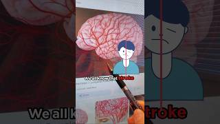 Diabetes and Your Brain diabetes diabetescomplications brain brainhealth alzheimer alzheimers [upl. by Gardie]