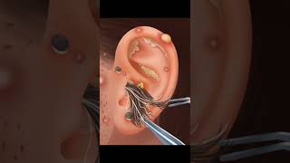 ASMR Ear Cleaning amp Treatment  Relaxing Animation asmr satisfying animation [upl. by Yhtimit]