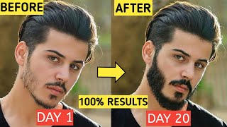 5 ULTIMATE BEARD Growth Hacks For Teenagers At Home 100 RESULTS  Patchy Beard Solution In Hindi [upl. by Arihsat]