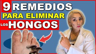 ¡Elimina HONGOS en las UÑAS en 24 HORAS  9 REMEDIOS NATURALES para HONGOS en las UÑAS 😲 [upl. by Elysee897]