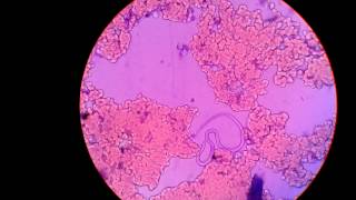 Live MicrofilariaParasite In Blood Under Microscope Captured In My Camera [upl. by Enyalahs]