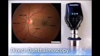 Direct Ophthalmoscopy [upl. by Borreri]