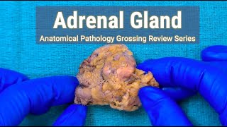 Adrenal Gland  Anatomical Pathology Grossing Review Series [upl. by Eizus]