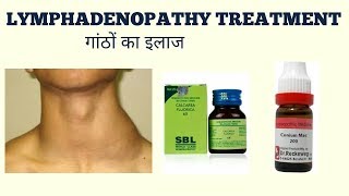 LYMPHADENOPATHY TREATMENTगांठों का ईलाज [upl. by Jp162]