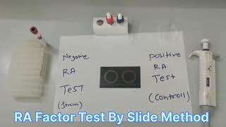 RA factor  A rheumatoid factor test By Slide Method [upl. by Birgitta]