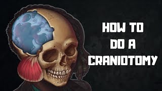 How to do a craniotomy [upl. by Eittam]