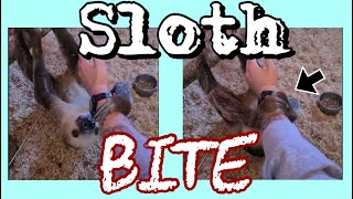 Sloth Attack Bite Video Footage [upl. by Tunnell]