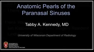 01 Imaging Anatomy of Paranasal Sinuses [upl. by Avelin]