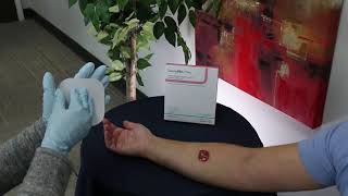 How to Apply DermaRites DermaFilm Thin Wound Dressing [upl. by Herates]