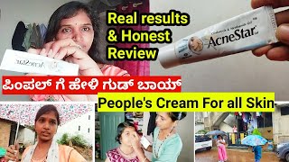 ಮೊಡವೆಗಳಿಗೆ ಹೇಳಿ ಗುಡ್ ಬಾಯ್  How to remove pimples with AcneStar Gel  pimples tips in kannada [upl. by Hulbig]