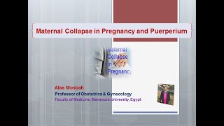 Maternal Collapse in Pregnancy and Puerperium [upl. by Ailaza263]