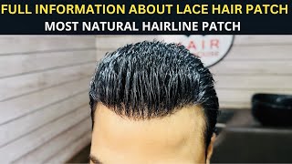 Premium Lace Hair Patch  Full Information About Frontlace Hair patch  Hair wig house [upl. by Renate]