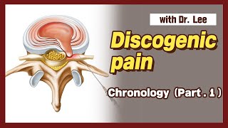 Chronology of discogenic pain  biomechanics clinical features lecture spine [upl. by Anippesuig441]