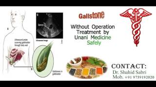 Gallstone पित्त की पथरी Treatment by Unani Medicine Safely [upl. by Aric]