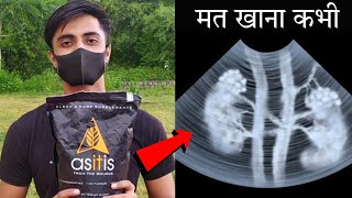 ASITIS Side Effects  हो गया खुलासा इस सस्ते ब्रांड का  Asitis Review protein gymlife [upl. by Imoyn]