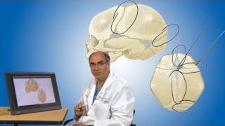 Plagiocephaly and its treatment  Boston Children’s Hospital [upl. by Ssilb]