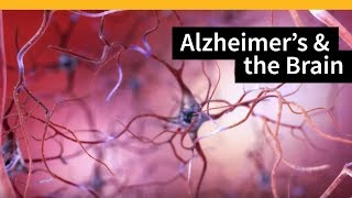 How Alzheimers Changes the Brain [upl. by Orton]