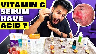 Testing The Best Vitamin C Serum For Indian Skin Shocking Result  BeYourBest Skincare San Kalra​ [upl. by Efeek403]