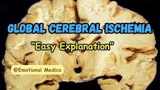 Global cerebral ischemia  Ischemia and infarction  CNS pathology  emotionalmedico [upl. by Eleanor]