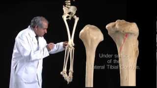 Lower Limb Fibula  Anatomy Tutorial [upl. by Ynohtnad]