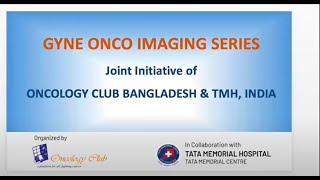 Gyne onco imaging series Final part [upl. by Dray]