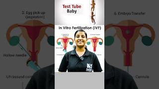 IVF or TEST TUBE BABY  जानिए कैसे TEST TUBE से होता है बच्चा [upl. by Ahsitauq468]