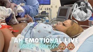 THE LIVE BIRTH OF OUR SECOND SET OF TWINS  Real Raw amp Emotional Doctor Turns Breech Baby in Womb [upl. by Isied722]