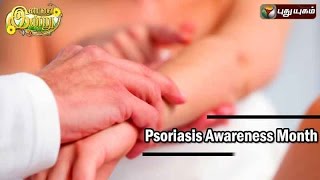 Psoriasis Awareness Month In Iniyavai Indru  13082016 I Puthuyugam TV [upl. by Enicul]