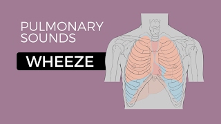 Lung sounds Types amp Causes Made SUPER Easy Abnormal Crackles Rales Wheezes Rhonchi Stridor Pleural [upl. by Ayala578]