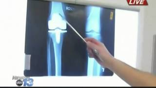 How to read a Knee XRay [upl. by Angie]