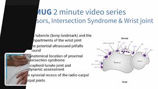 Wrist Extensors Intersection Syndrome amp Wrist joint  2 min series MSKUS [upl. by Sonaj]